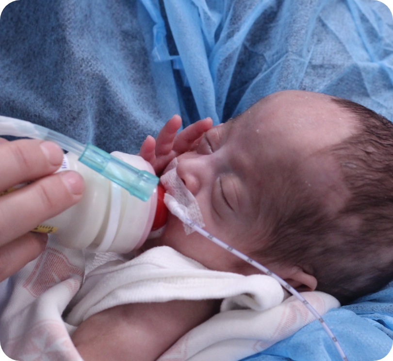 Premature baby with a feeding tube being bottle-fed while wrapped in a blanket.